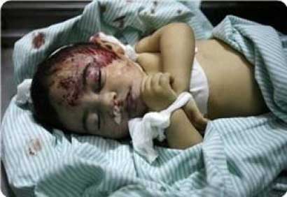 10 morts dimanche à Gaza, ce qui porte à 98 le nombre de victims depuis que l’holocauste israélien a commencé mercredi
