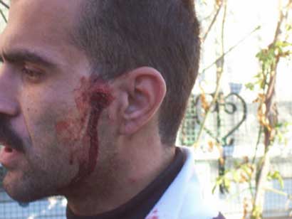 Hébron : Les colons continuent à occuper un terrain palestinien et à attaquer les Palestiniens sous les yeux de la police et de l’armée d’occupation