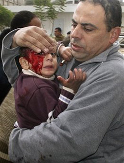 Victimes de la dernière expérimentation d’Israël