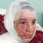 Les membres de la famille Abu Halima tués et brûlés par le bombardement de leur maison par l’armée israélienne, le 3 janvier 2009