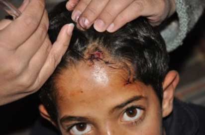 Des colons blessent 10 Palestiniens à Hébron