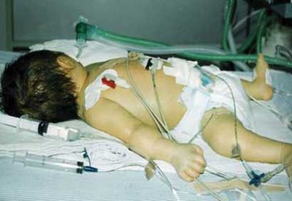 La mort lente de Gaza